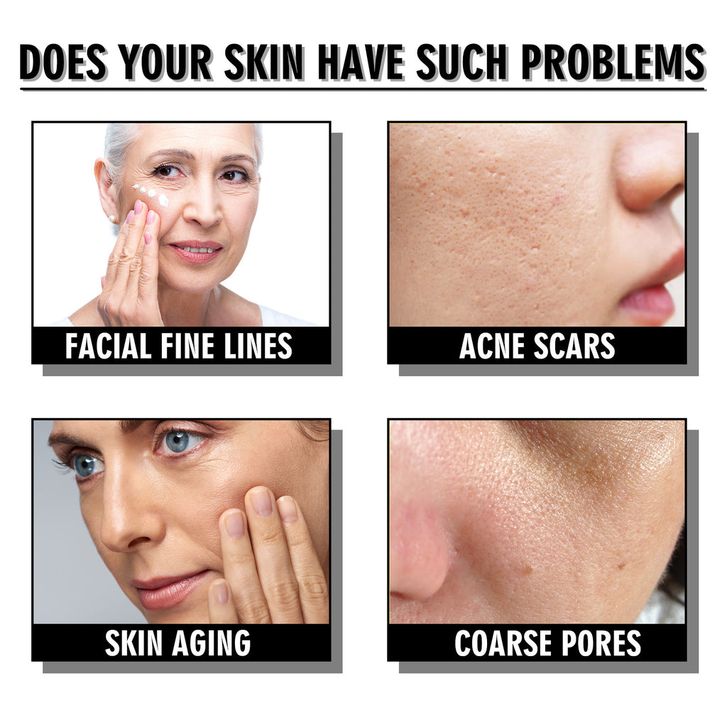 Snail Repair Cream – Wrinkle Fading & Skin Firming Moisturizer