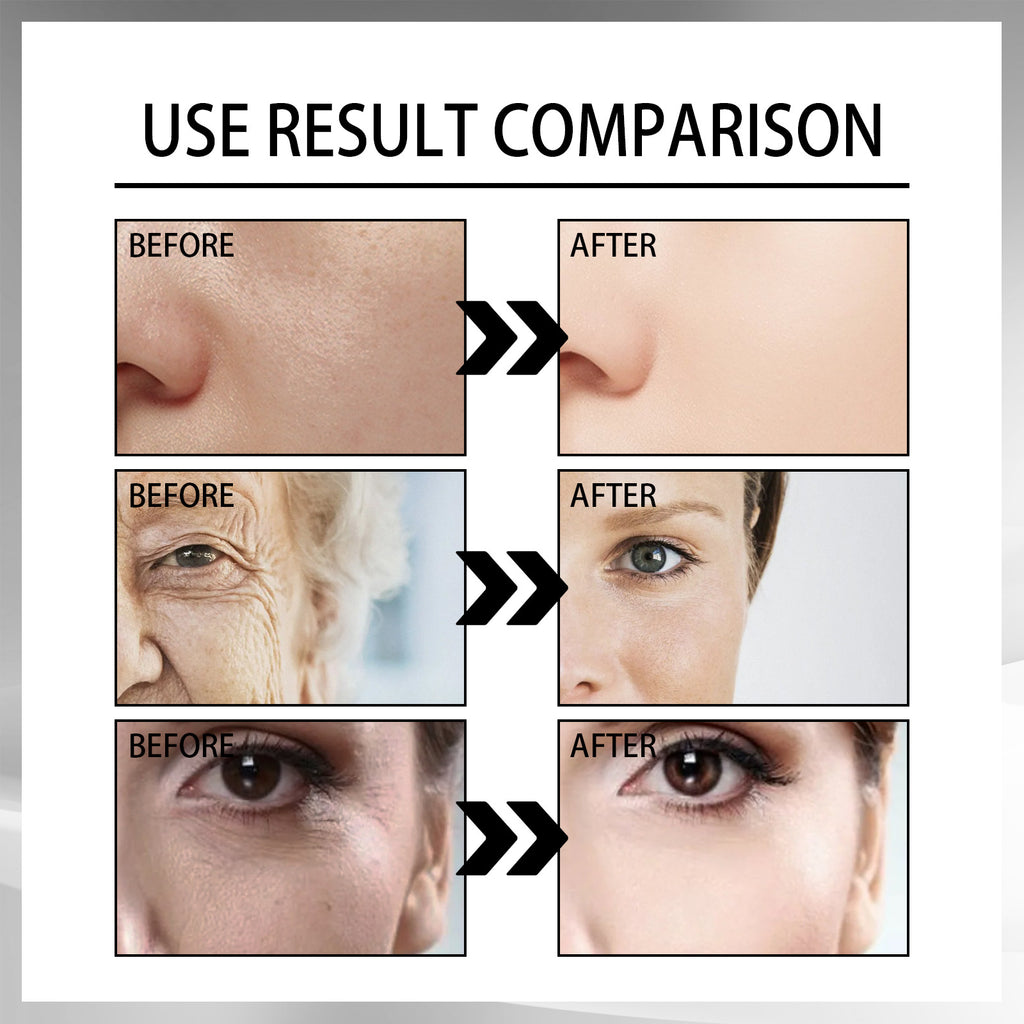 Snail Repair Cream – Wrinkle Fading & Skin Firming Moisturizer